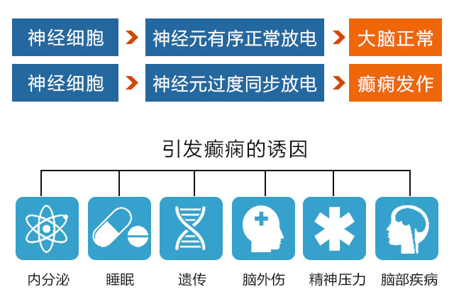 癫痫病最新治疗进展概览